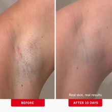 Load image into Gallery viewer, First Aid Beauty - Ingrown Hair Pads with BHA + AHA - Aftershave Treatment Pads to Help Prevent Razor Bumps for Men & Women - Exfoliate Underarms & Bikini Area - Compostable for Daily Use - 28 Pads